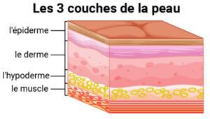 Les ampoules, un décollement de l’épiderme